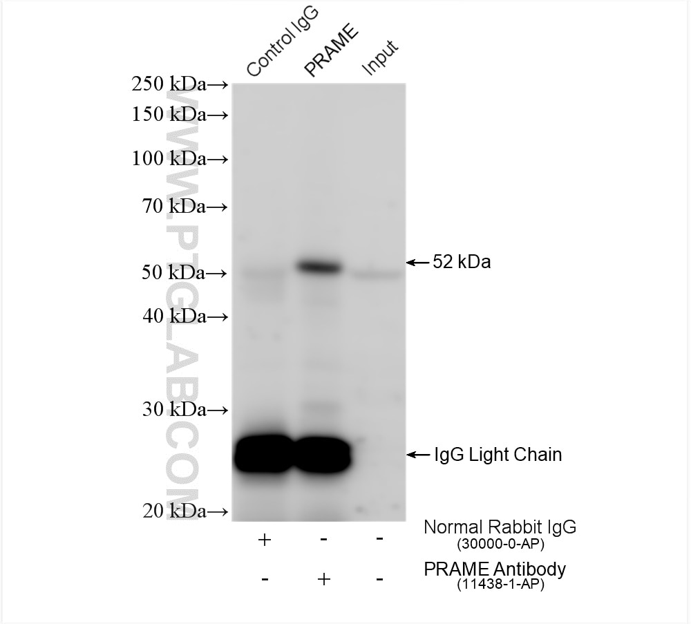 Immunoprecipitation (IP) experiment of K-562 cells using PRAME Polyclonal antibody (11438-1-AP)