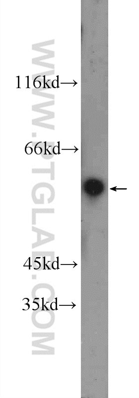 PRAME Polyclonal antibody