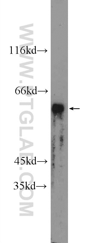 Western Blot (WB) analysis of HepG2 cells using PRAME Polyclonal antibody (11438-1-AP)