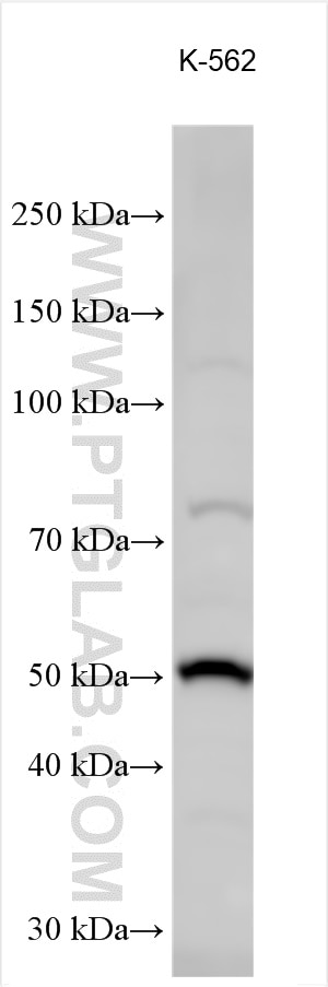 Western Blot (WB) analysis of various lysates using PRAME Polyclonal antibody (11438-1-AP)