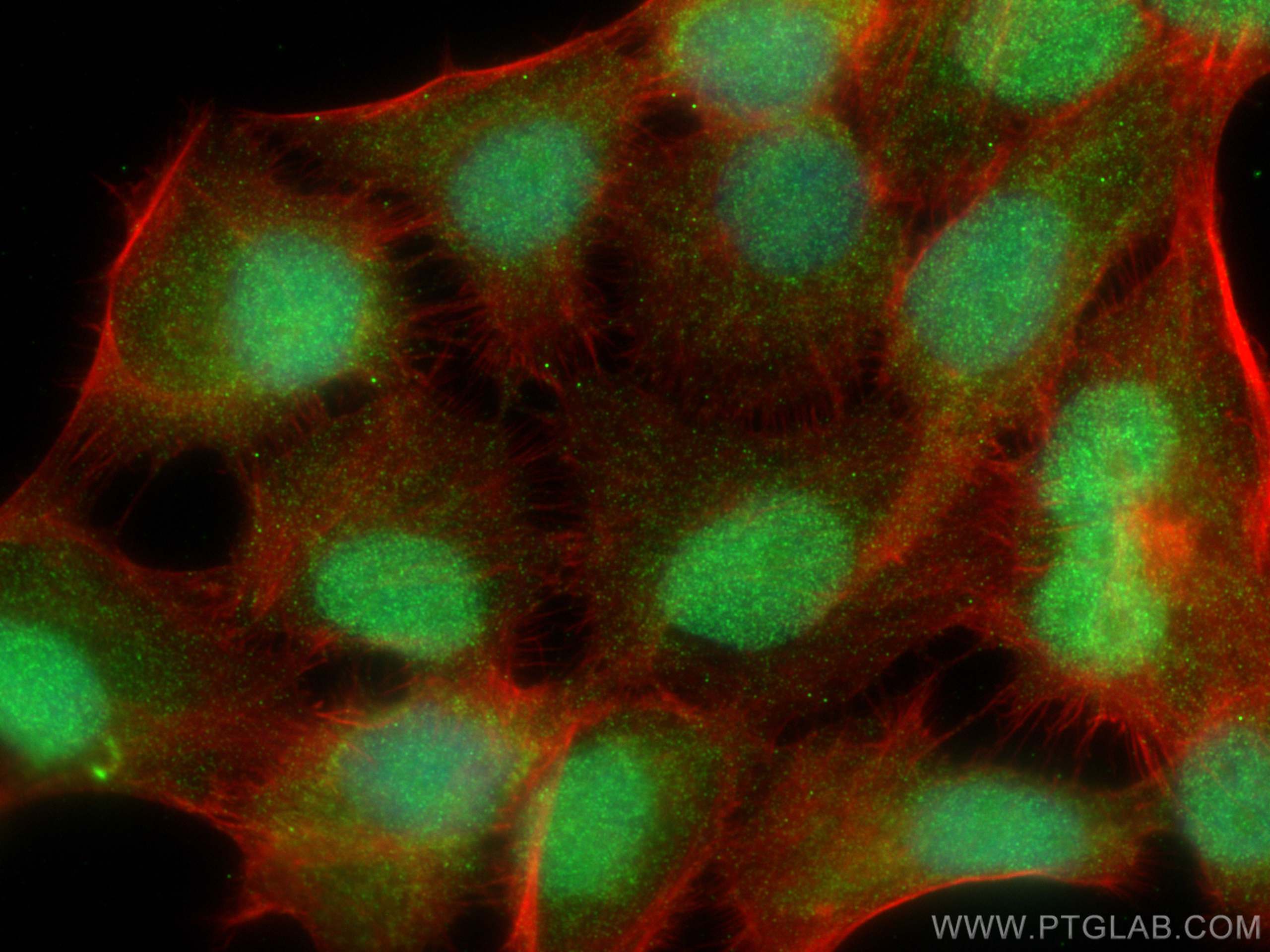Immunofluorescence (IF) / fluorescent staining of HaCaT cells using PRAME Monoclonal antibody (68097-1-Ig)