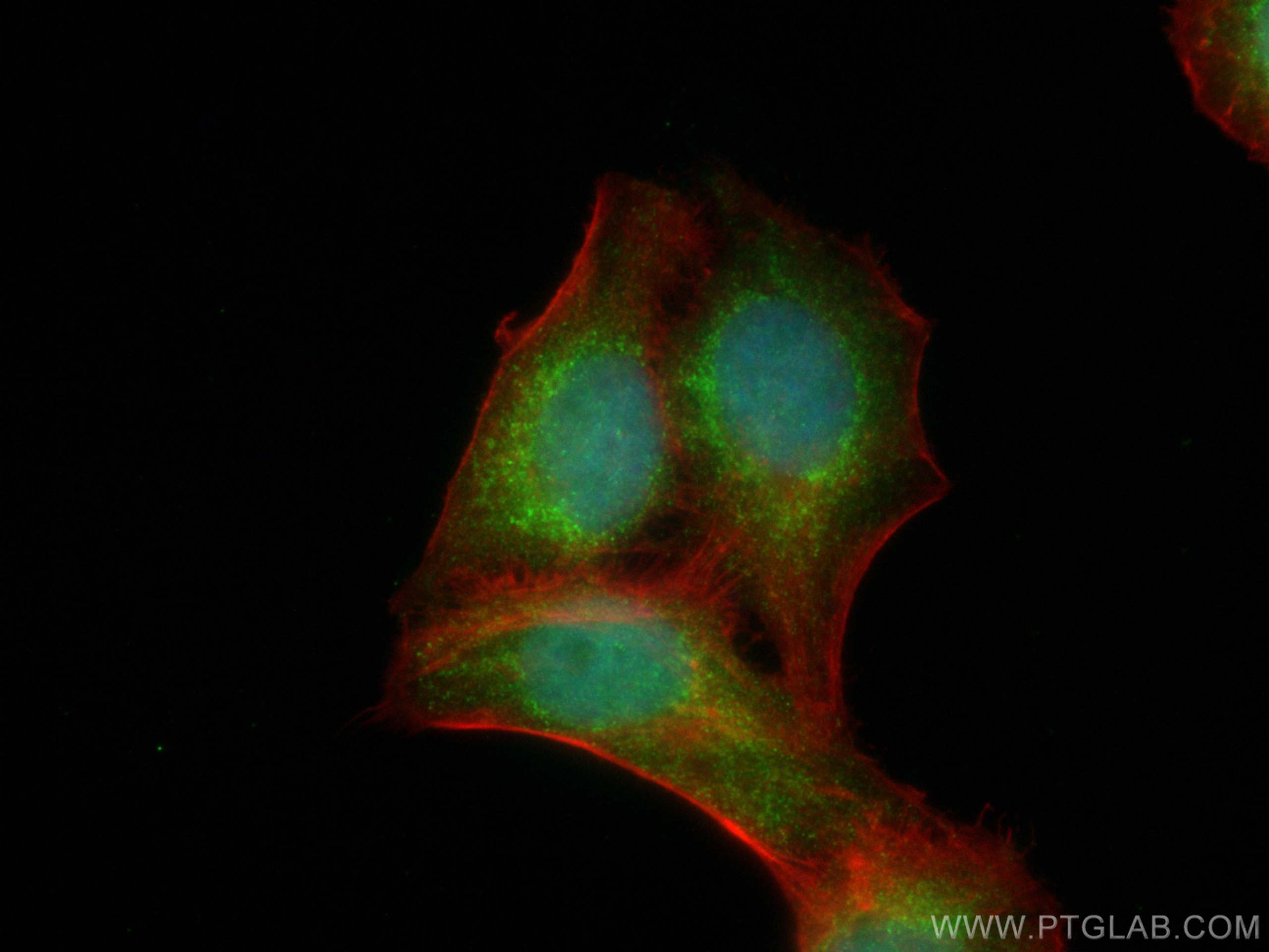 Immunofluorescence (IF) / fluorescent staining of HaCaT cells using CoraLite® Plus 488-conjugated PRAME Monoclonal ant (CL488-68097)