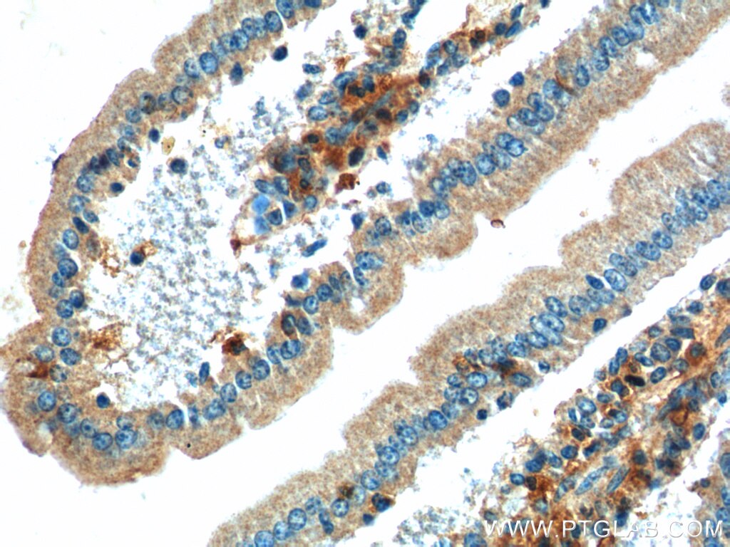 IHC staining of mouse small intestine using 11932-1-AP