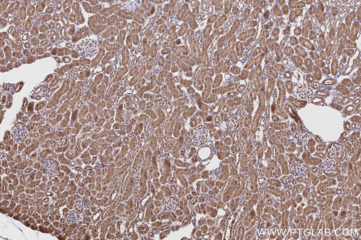 Immunohistochemistry (IHC) staining of mouse kidney tissue using PRAP1 Polyclonal antibody (11932-1-AP)