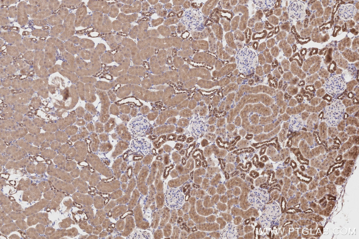 Immunohistochemistry (IHC) staining of rat kidney tissue using PRAP1 Polyclonal antibody (11932-1-AP)