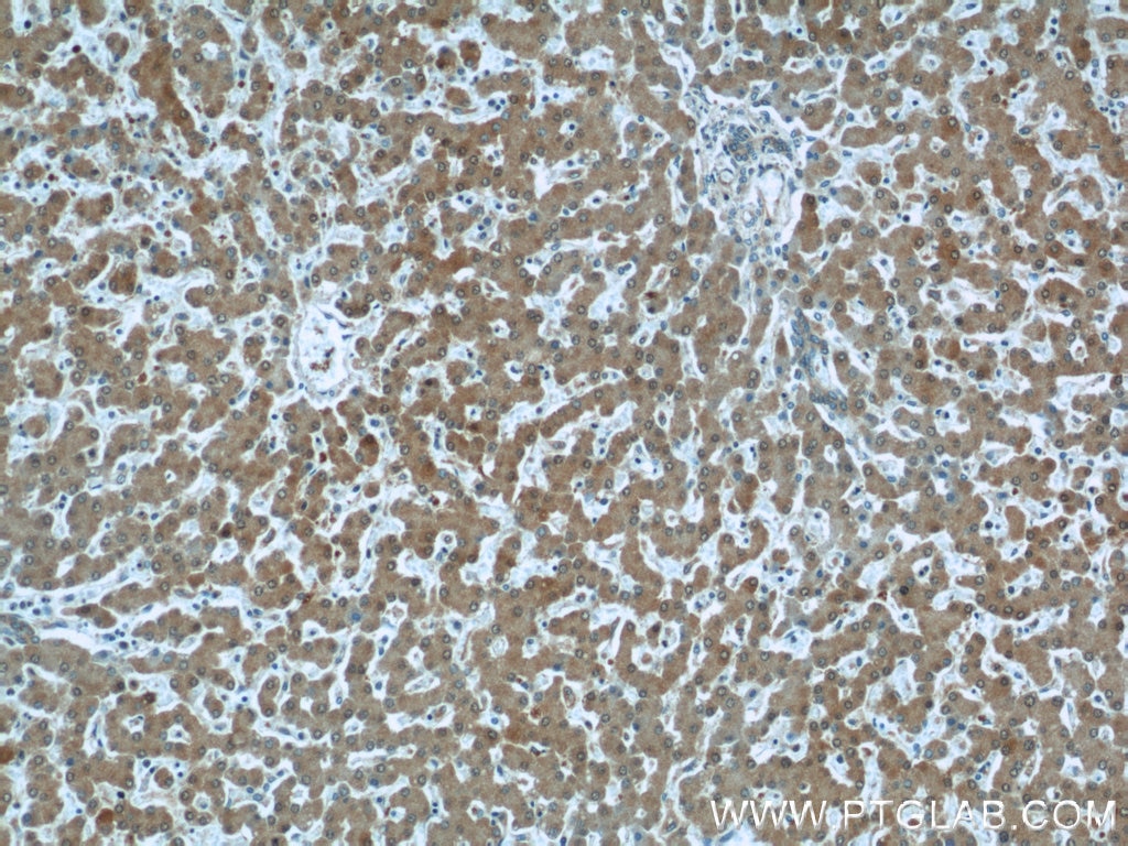 Immunohistochemistry (IHC) staining of human liver tissue using PRAP1 Polyclonal antibody (11932-1-AP)