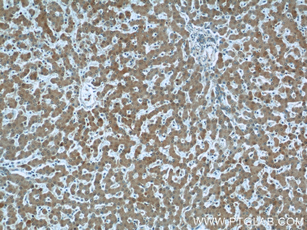 IHC staining of human liver using 11932-1-AP