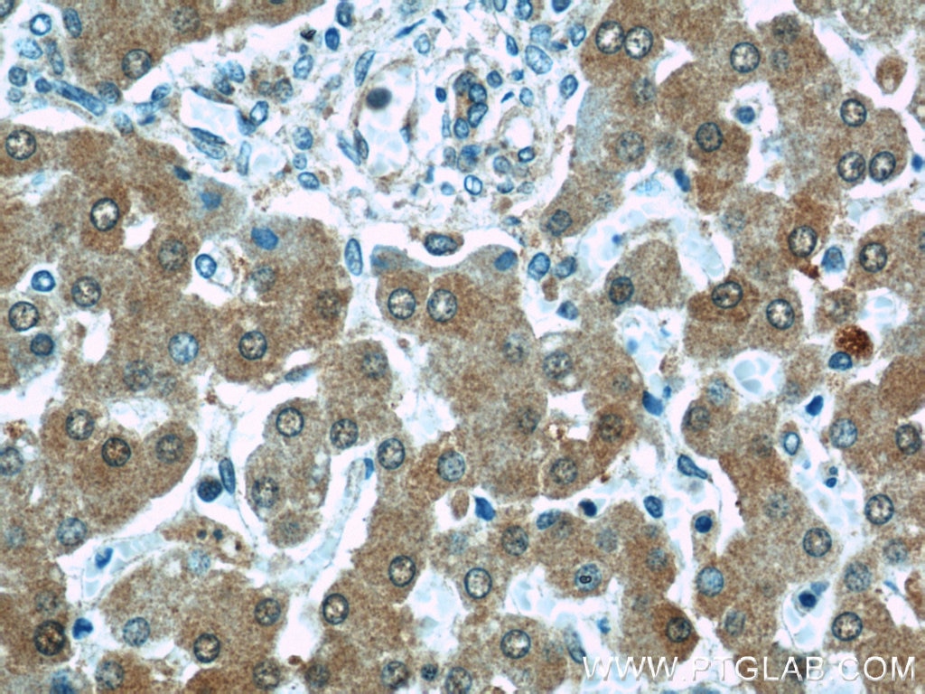 Immunohistochemistry (IHC) staining of human liver tissue using PRAP1 Polyclonal antibody (11932-1-AP)