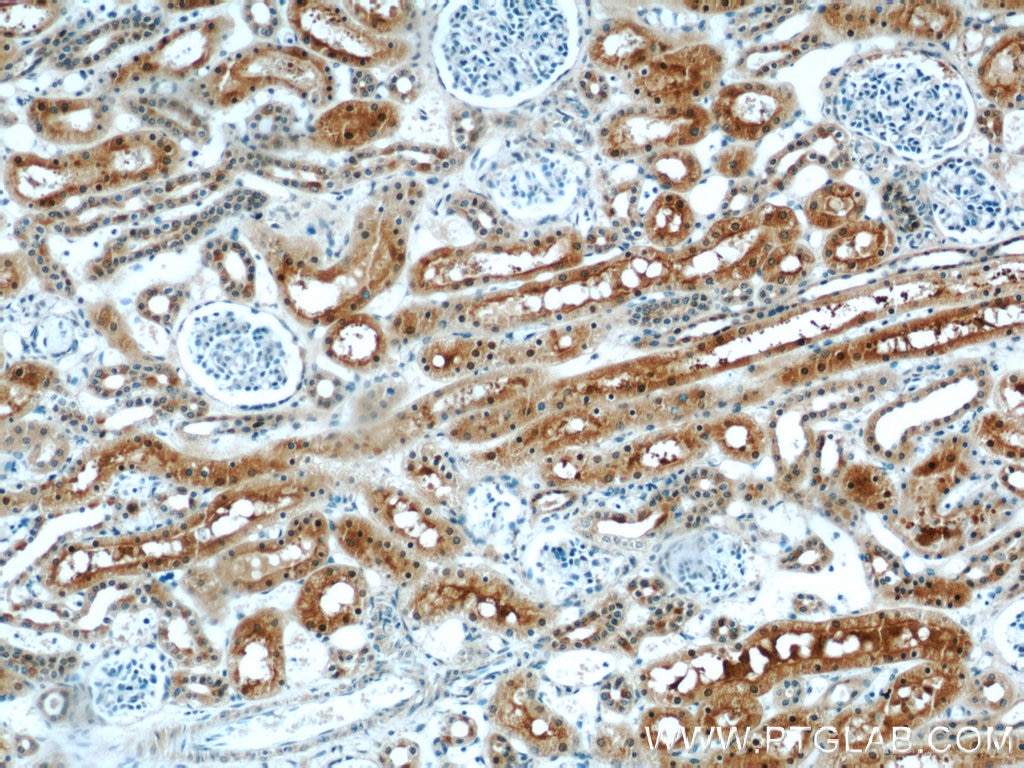 Immunohistochemistry (IHC) staining of human kidney tissue using PRAP1 Polyclonal antibody (11932-1-AP)