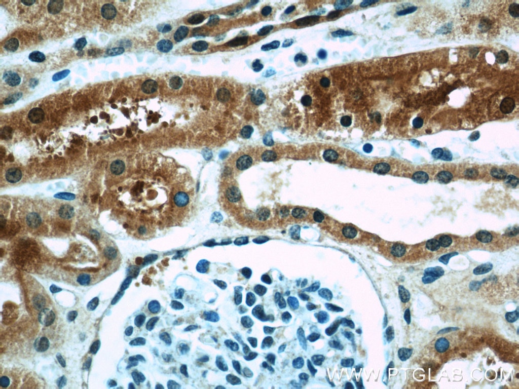 Immunohistochemistry (IHC) staining of human kidney tissue using PRAP1 Polyclonal antibody (11932-1-AP)