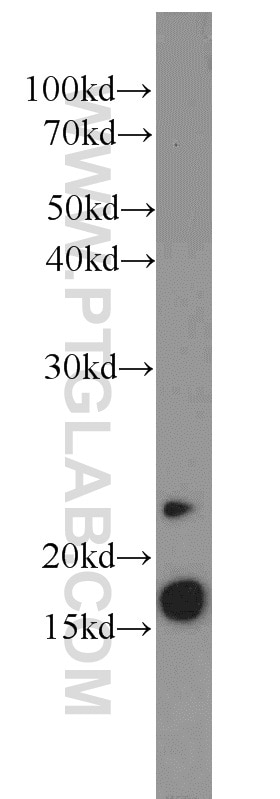 Western Blot (WB) analysis of mouse pancreas tissue using PRAP1 Polyclonal antibody (11932-1-AP)