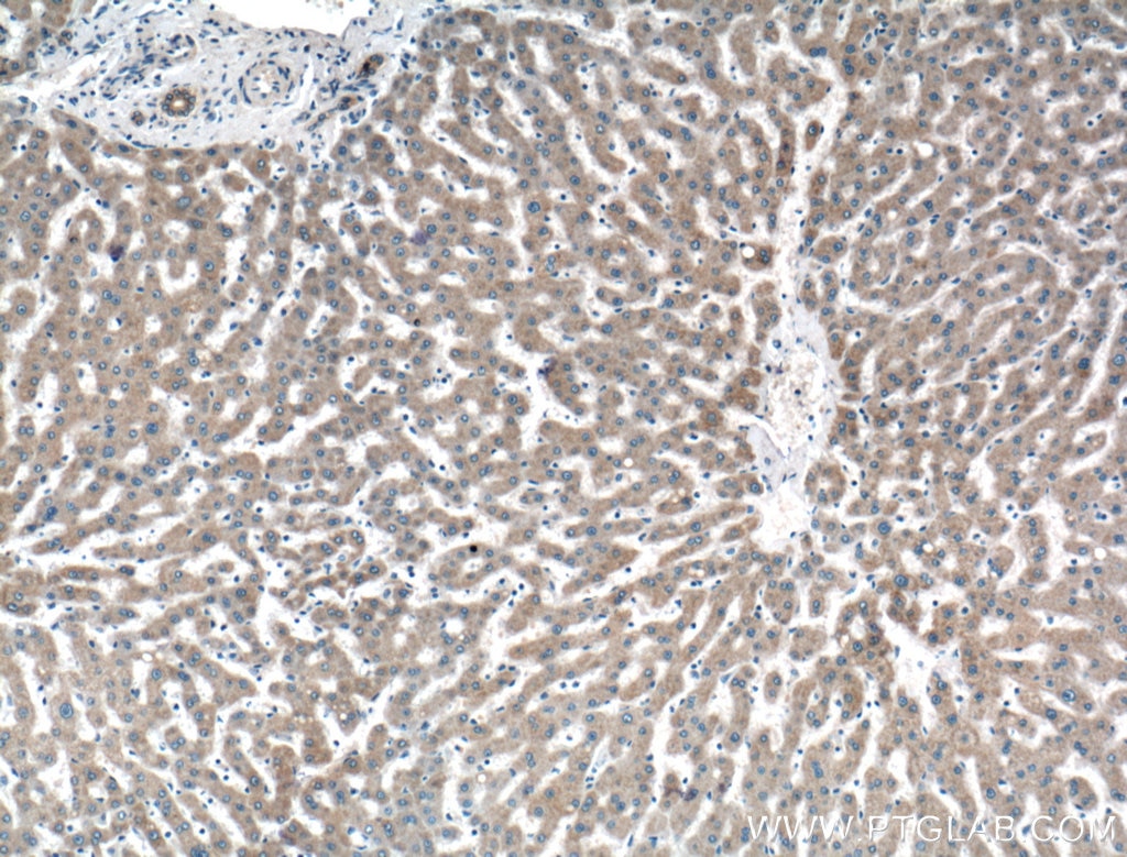 Immunohistochemistry (IHC) staining of human liver tissue using PRAS40 Polyclonal antibody (21097-1-AP)