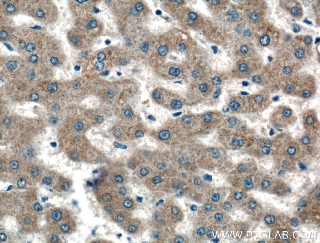 Immunohistochemistry (IHC) staining of human liver tissue using PRAS40 Polyclonal antibody (21097-1-AP)