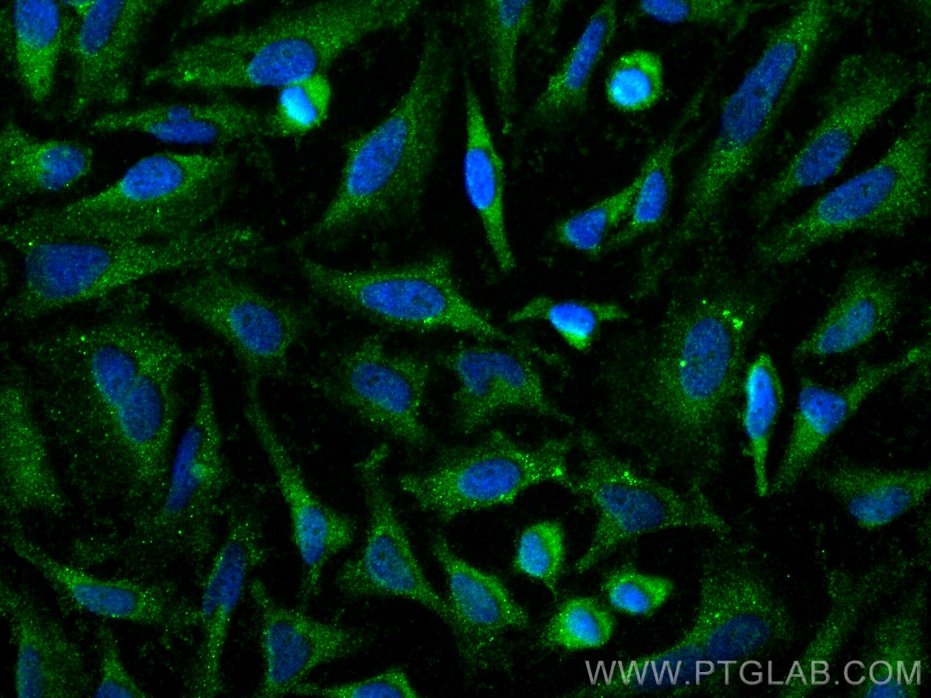 Immunofluorescence (IF) / fluorescent staining of HeLa cells using PRAS40 Polyclonal antibody (32456-1-AP)