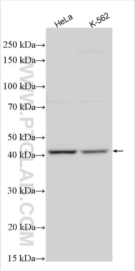 Western Blot (WB) analysis of various lysates using PRB1 Polyclonal antibody (25675-1-AP)