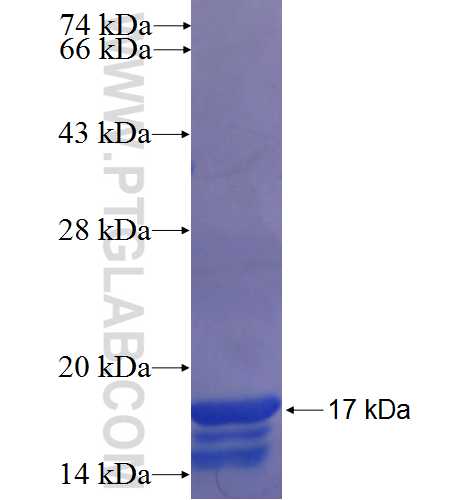 PRB1 fusion protein Ag22475 SDS-PAGE