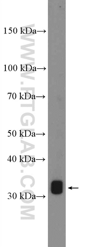 Western Blot (WB) analysis of fetal human brain tissue using PRB3 Polyclonal antibody (22190-1-AP)