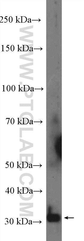 Western Blot (WB) analysis of mouse brain tissue using PRB3 Polyclonal antibody (22190-1-AP)