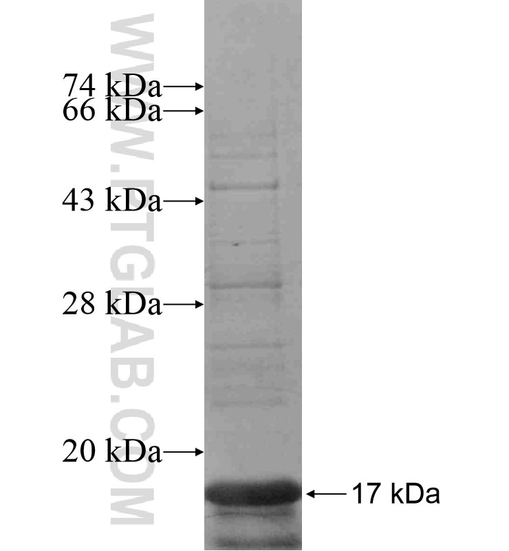 PRB3 fusion protein Ag16760 SDS-PAGE