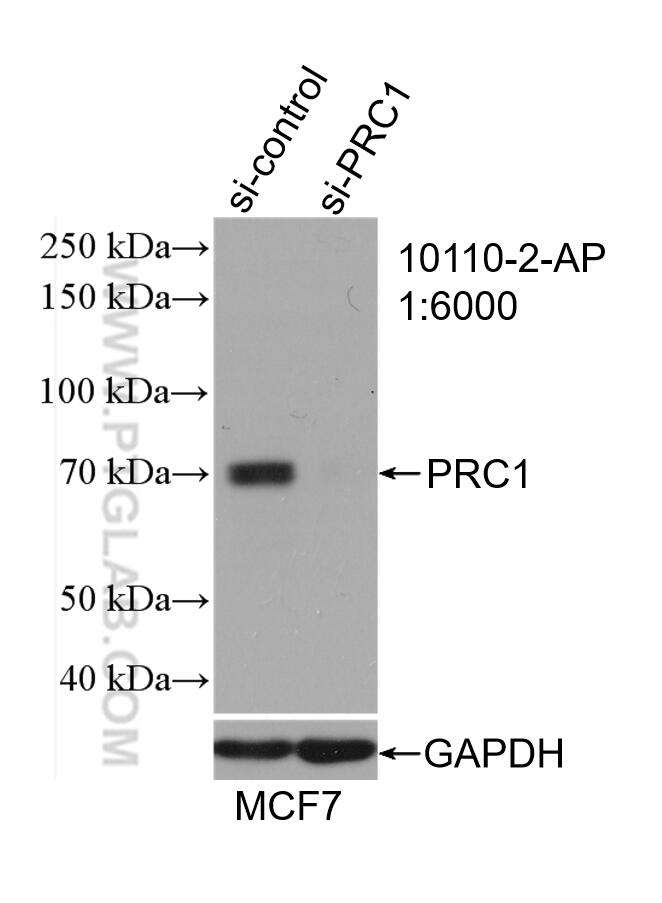 Western Blot (WB) analysis of MCF-7 cells using PRC1 Polyclonal antibody (10110-2-AP)