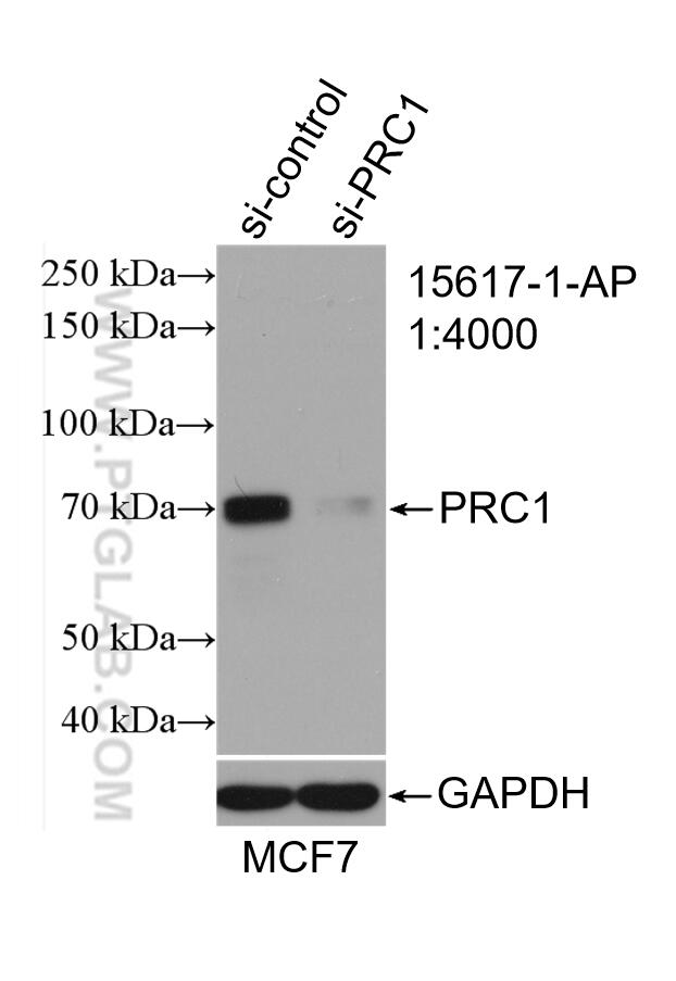 Western Blot (WB) analysis of MCF-7 cells using PRC1 Polyclonal antibody (15617-1-AP)