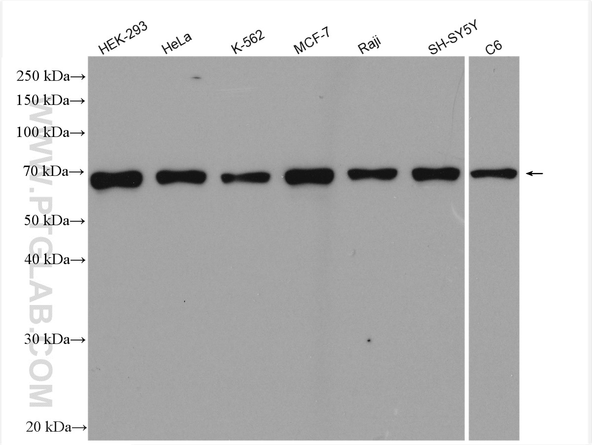 Western Blot (WB) analysis of various lysates using PRC1 Polyclonal antibody (15617-1-AP)