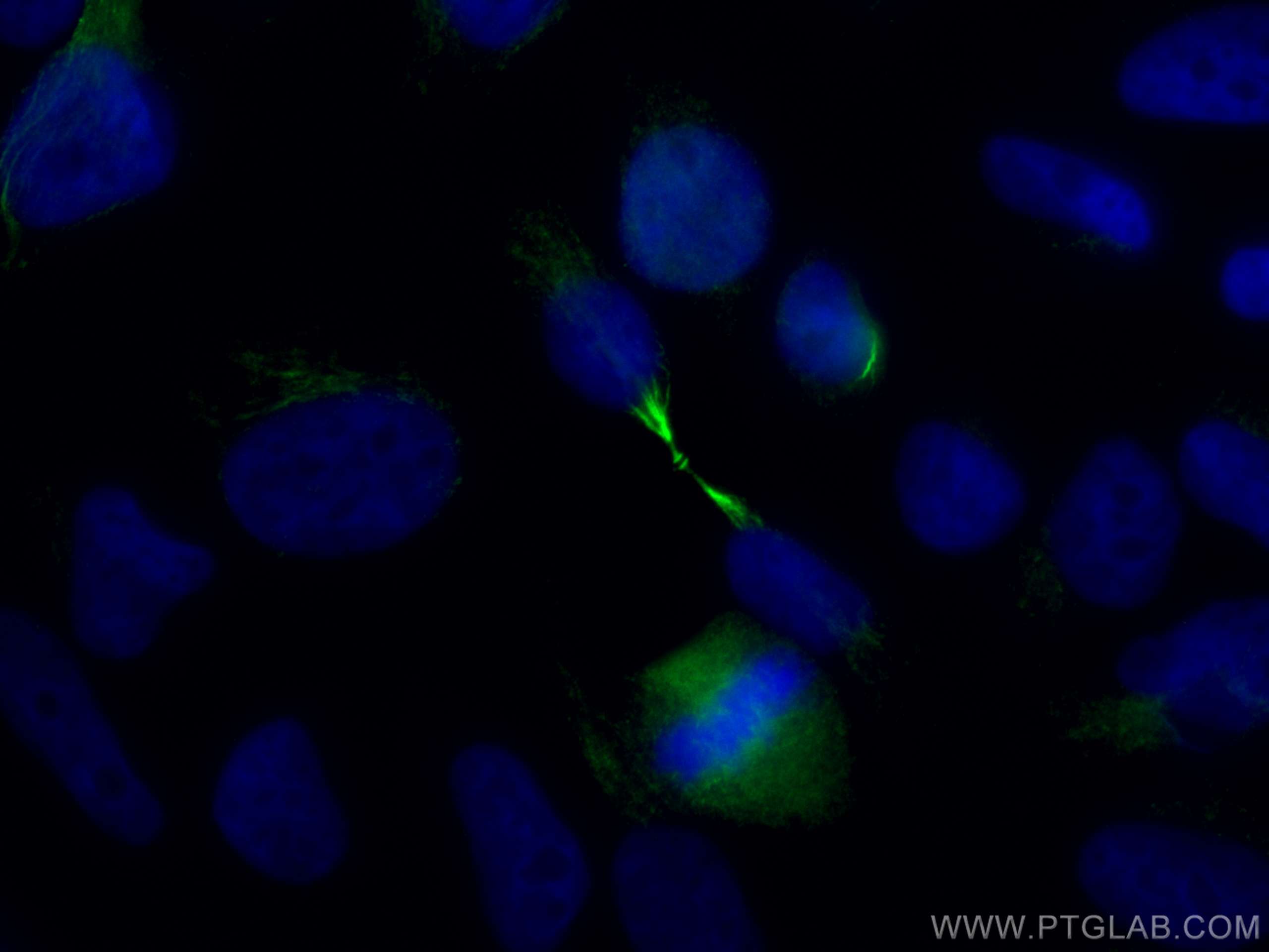 Immunofluorescence (IF) / fluorescent staining of HeLa cells using PRC1 Monoclonal antibody (67027-1-Ig)