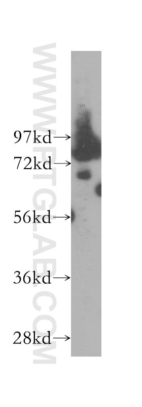 Western Blot (WB) analysis of HeLa cells using PRCC Polyclonal antibody (12019-1-AP)