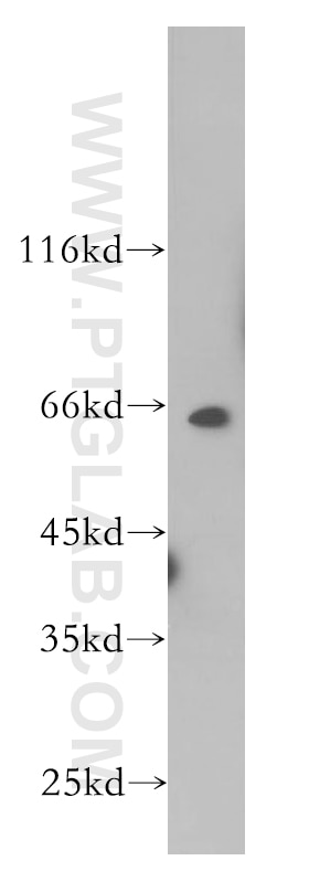 WB analysis of HeLa using 12019-1-AP