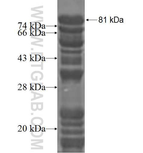 PRCC fusion protein Ag2638 SDS-PAGE