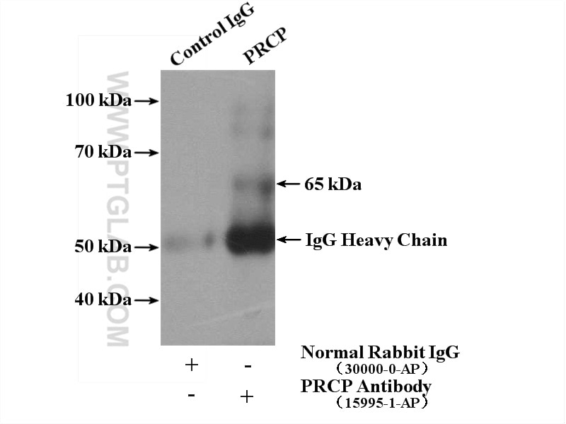 Immunoprecipitation (IP) experiment of L02 cells using PRCP Polyclonal antibody (15995-1-AP)