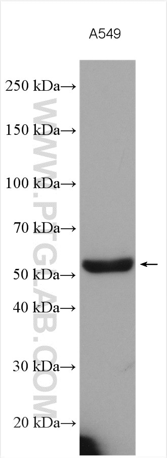 Western Blot (WB) analysis of various lysates using PRCP Polyclonal antibody (15995-1-AP)