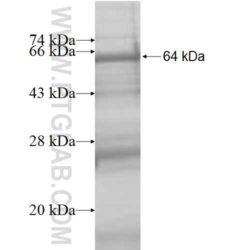 PRCP fusion protein Ag8869 SDS-PAGE