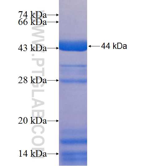 PRCP fusion protein Ag9095 SDS-PAGE