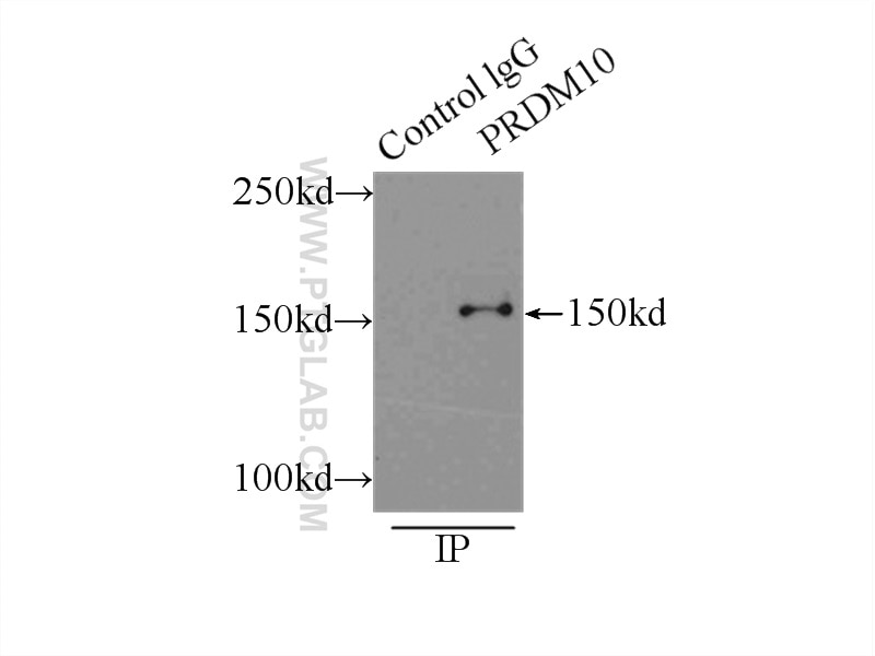 Immunoprecipitation (IP) experiment of mouse testis tissue using PRDM10 Polyclonal antibody (23827-1-AP)