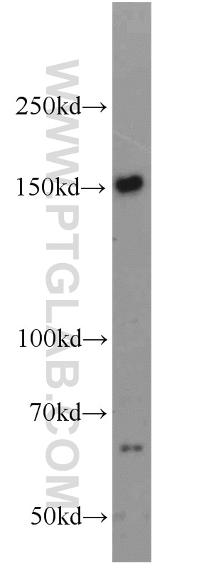 Western Blot (WB) analysis of HEK-293 cells using PRDM10 Polyclonal antibody (23827-1-AP)