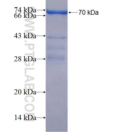 PRDM10 fusion protein Ag20605 SDS-PAGE