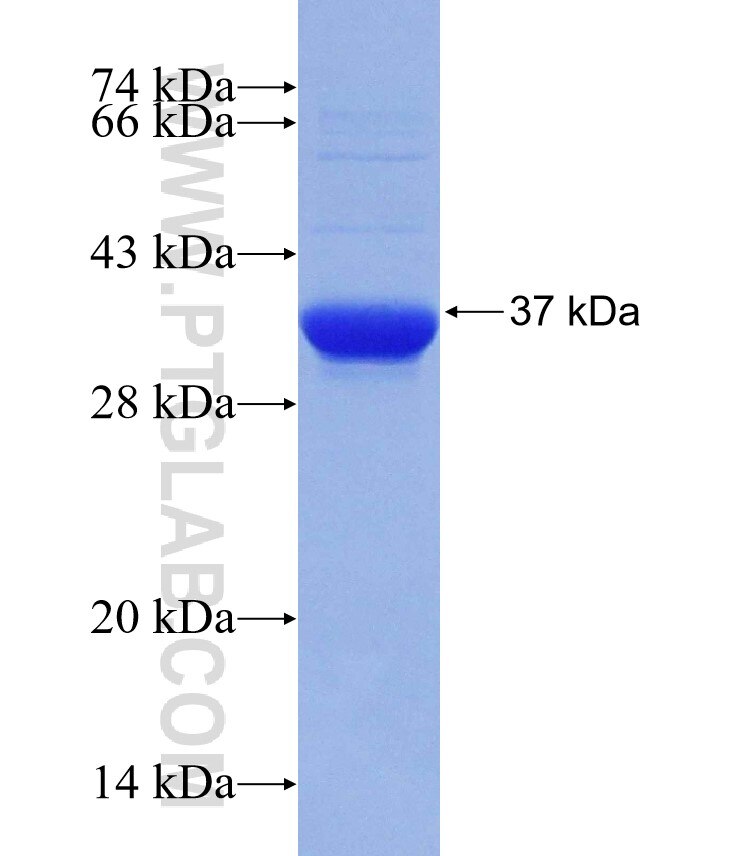 PRDM12 fusion protein Ag30655 SDS-PAGE