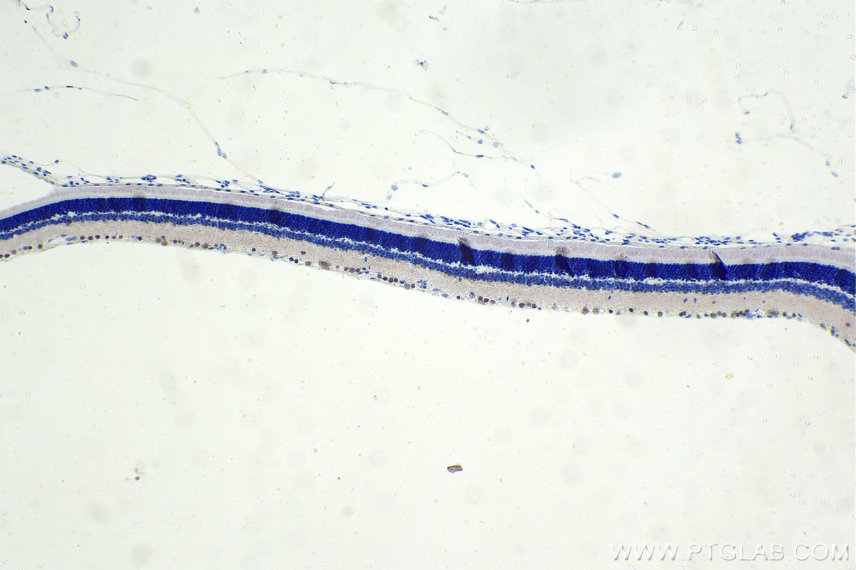 Immunohistochemistry (IHC) staining of rat eye tissue using PRDM13 Polyclonal antibody (30453-1-AP)