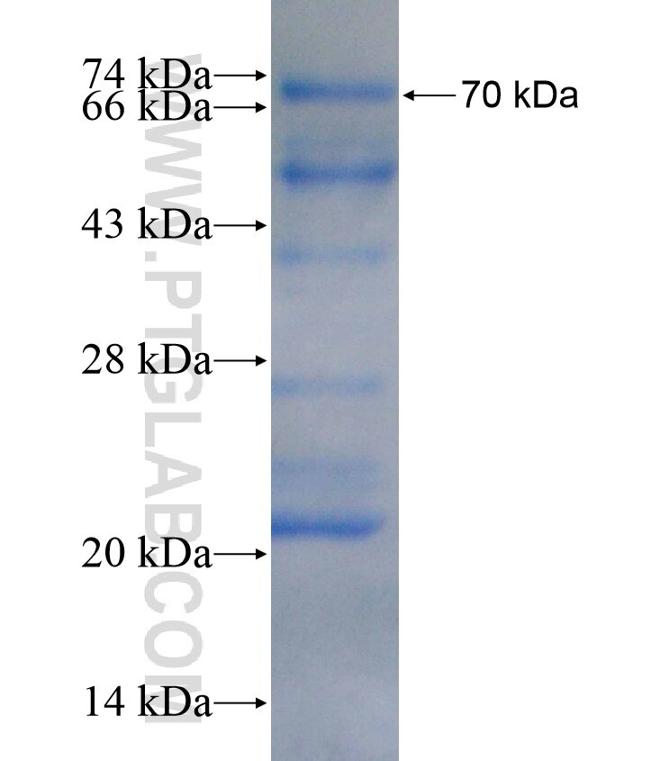 PRDM14 fusion protein Ag18025 SDS-PAGE