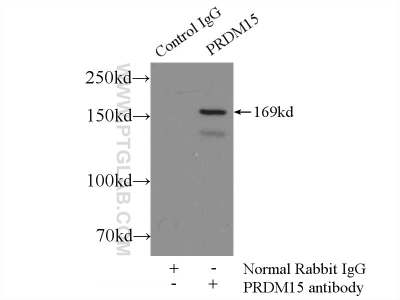 Immunoprecipitation (IP) experiment of MCF-7 cells using PRDM15 Polyclonal antibody (25590-1-AP)