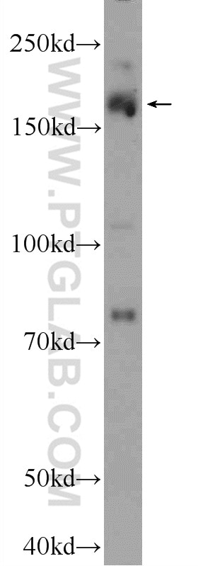 Western Blot (WB) analysis of MCF-7 cells using PRDM15 Polyclonal antibody (25590-1-AP)