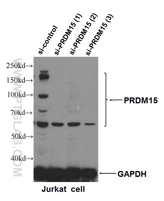Western Blot (WB) analysis of Jurkat cells using PRDM15 Polyclonal antibody (25590-1-AP)