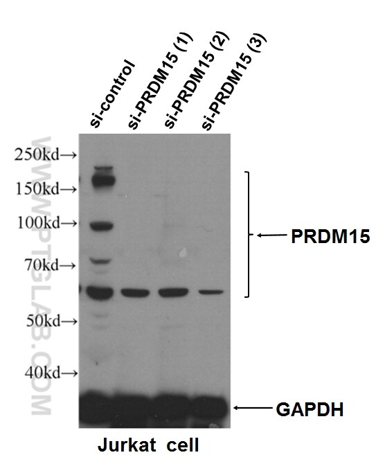 PRDM15