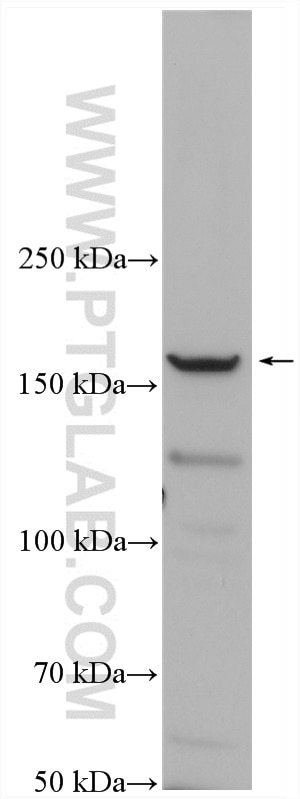 Western Blot (WB) analysis of K-562 cells using PRDM16 Polyclonal antibody (55361-1-AP)