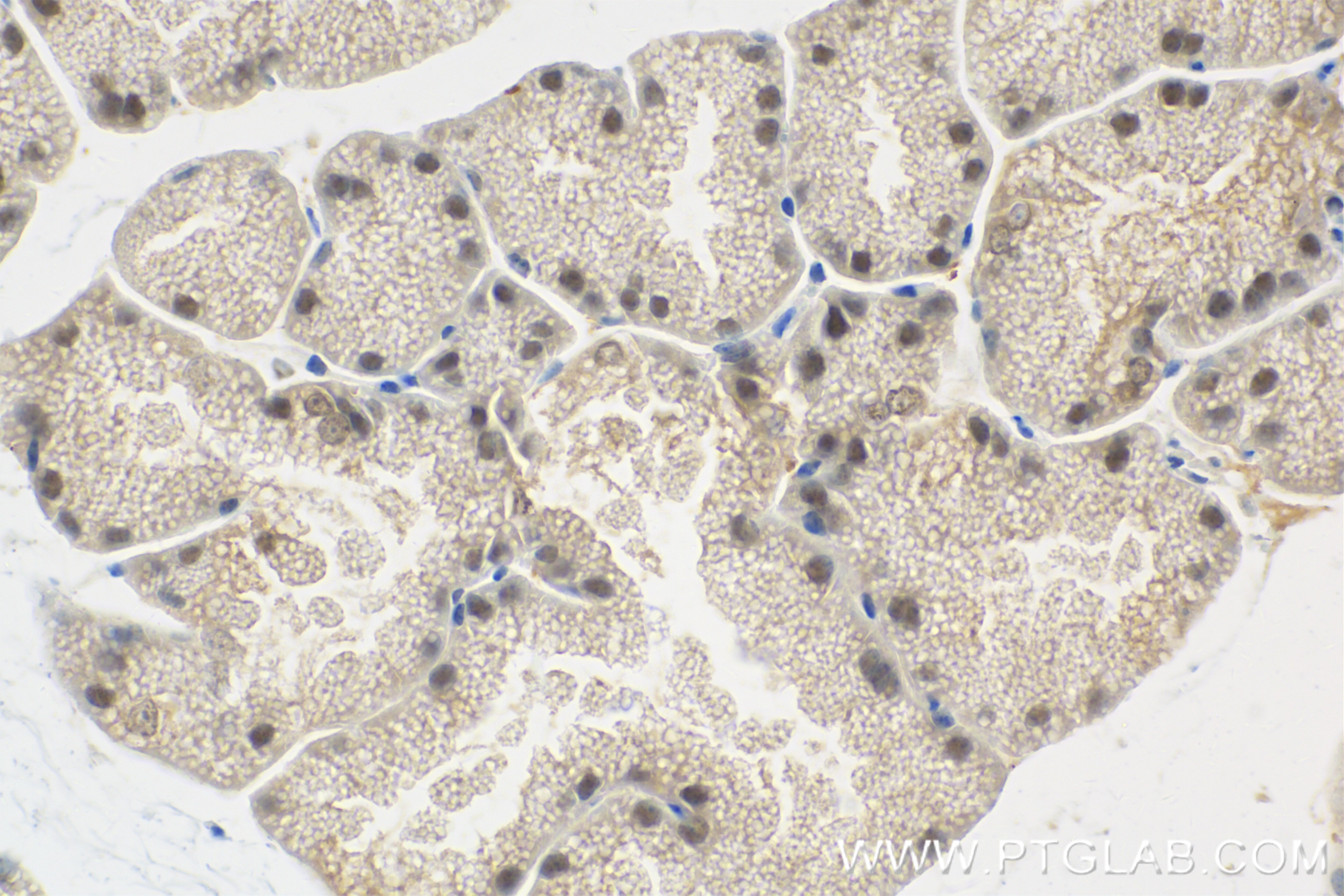 Immunohistochemistry (IHC) staining of mouse brown adipose tissue using PRDM16 Recombinant antibody (83872-1-RR)