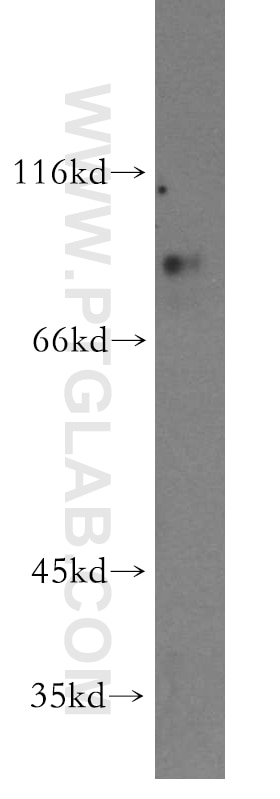 Western Blot (WB) analysis of mouse pancreas tissue using PRDM4 Polyclonal antibody (13792-1-AP)