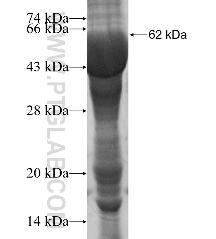 PRDM4 fusion protein Ag4580 SDS-PAGE