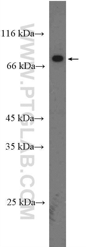 Western Blot (WB) analysis of mouse ovary tissue using PRDM5 Polyclonal antibody (14126-1-AP)