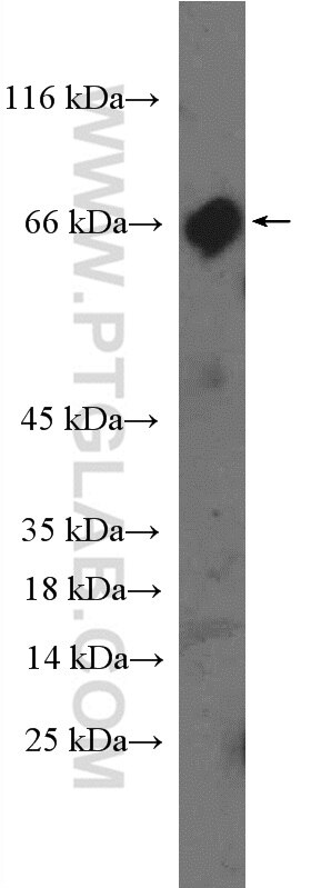 Western Blot (WB) analysis of mouse colon tissue using PRDM5 Polyclonal antibody (14126-1-AP)